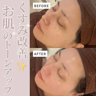 💚THE BALM 金子💚✨のエステ・リラクイメージ