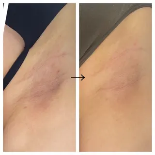 ビューティー ミロワールのエステ・リラクイメージ