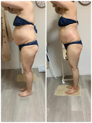 美ボディメイクサロン　only one body所属・所沢 痩身エステサロンのエステ・リラクイメージ