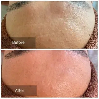 メンズ 美肌・リラクゼーションサロンLu,Mie所属・美肌と癒しのサロン Lu,Mieのエステ・リラクイメージ