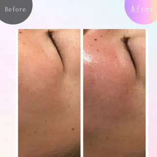 Silky ✖︎ Snow White｜エイジングケア＆美肌脱毛専門サロン所属・O 朋美のエステ・リラクイメージ