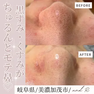 and R 男女 脱毛、毛穴サロンのエステ・リラクイメージ