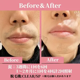 メンズ 有人型セルフサロン 脱毛/痩身/美顔のその他イメージ