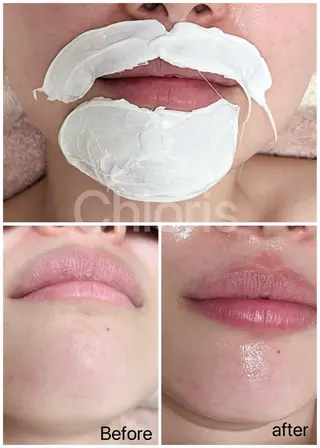 川越ローマピンク 光脱毛＆ワックス脱毛のエステ・リラクイメージ