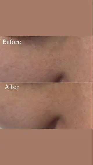 Del'm豊橋所属・豊橋De'Im 安部のエステ・リラクイメージ