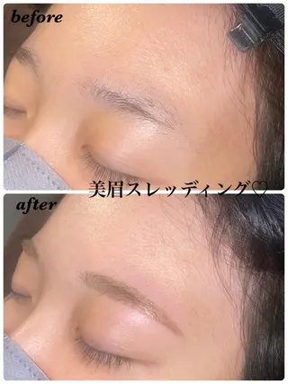 アイブロウ ハーブピーリング/韓国肌管理/フェイシャル/毛穴洗浄/眉毛/顔脱毛【糸脱毛専門】rev所属・ハーブピーリング🌹 毛穴洗浄❤️眉waxのエステ・リラクイメージ