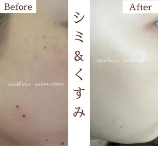 都度払い 肌質改善専門サロンのエステ・リラクイメージ