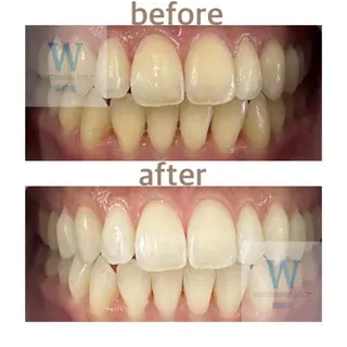 ホワイトニング ショップ船橋店🦷のエステ・リラクイメージ