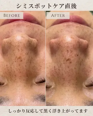 シミ毛穴|眉Wax THE  flowのエステ・リラクイメージ