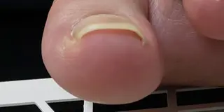 ネイル 爪屋 Orchidのネイルデザイン