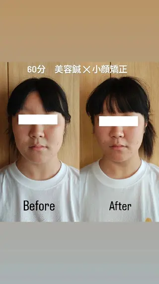 美容鍼灸サロンAria所属・美容鍼サロンAria 杉元みつるのエステ・リラクイメージ