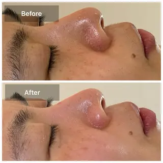 目元・まつパ・美肌フ ェイシャル谷町四丁目のマツエク・マツパデザイン