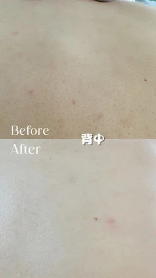 Hit. シュガーリング豊橋のエステ・リラクイメージ