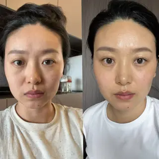 aliaハイフ&水光ジェットサロン所属・aliaハーブ水光店 エステティシャン募集のエステ・リラクイメージ