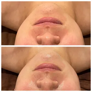 メンズ Meow！～トラブル肌専門ピーリング＆脱毛サロン～所属・トラブル肌改善🏥 Meow！🫧🫧のその他イメージ