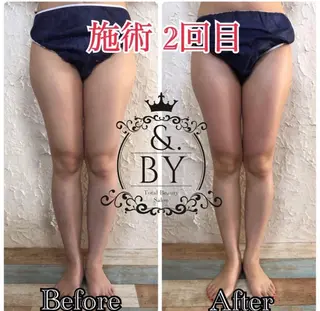 &. BYのエステ・リラクイメージ