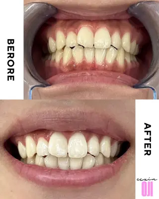 セルフホワイトニングサロン  エクシアホワイト 王寺店所属・エクシア王寺 NISHIKAWAのその他イメージ