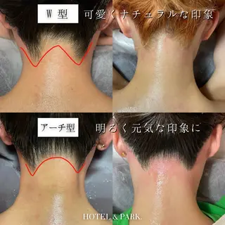 HOTEL&PARK . ワックス脱毛のエステ・リラクイメージ