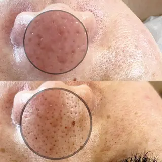 セミロング ヘアアレンジ ネイル マツエク・マツパ アイブロウ ワックス脱毛専門店 ICE 池袋の眉毛・アイブロウイメージ