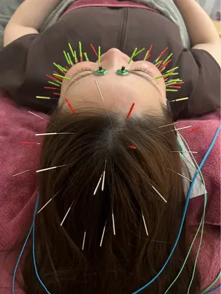 美容鍼灸女性専用 りんご鍼灸治療院のその他イメージ