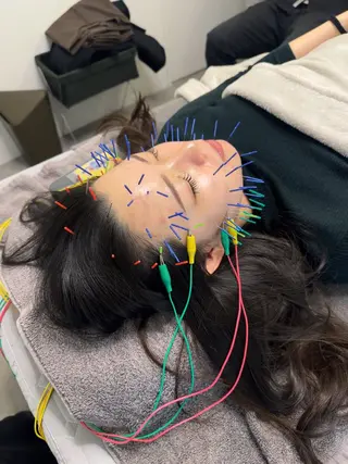 美容鍼＆鍼灸サロン 鍼Glitter.岡山駅前店所属・田中 美奈のエステ・リラクイメージ