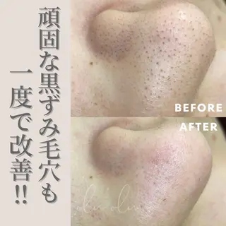 〈医療提携/毛穴・シミケア専門店〉 'Olu'Olu【オルオル】所属・'Olu'Olu シミ・毛穴専門サロンのエステ・リラクイメージ