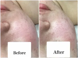 パーソナルエステ L'purのエステ・リラクイメージ