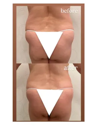 トータルビューティ サロンstageのエステ・リラクイメージ