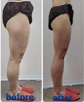 【 Laforme】 ラ・フォルムのエステ・リラクイメージ