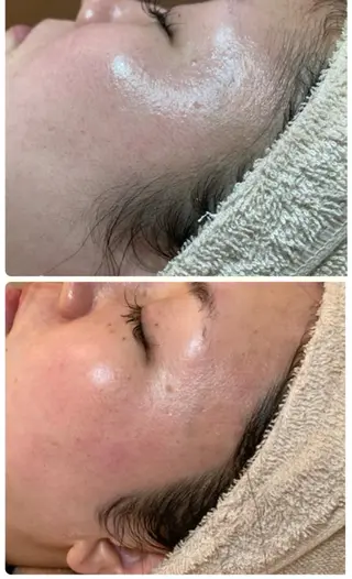 Le cherien所属・Le cherien ルシェリアのエステ・リラクイメージ