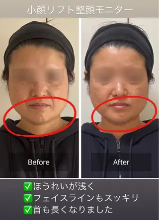 小顔リフト整顔/ 美肌サロンのその他イメージ
