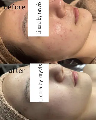 👑Linolaby RAYVIS👑⭐️のエステ・リラクイメージ