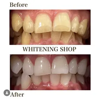 ホワイトニングショップ伊丹店所属・ホワイトニング ショップ伊丹店のその他イメージ