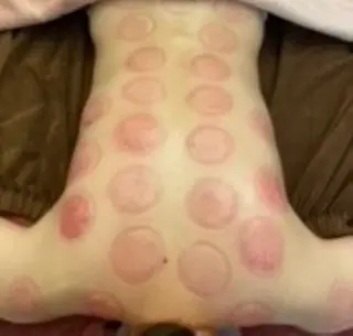 女性専用かっさサロン gloriefille所属・女性専用かっさサロン glorieのエステ・リラクイメージ