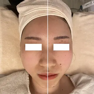 ララ/ハーブ メゾンリュバンのエステ・リラクイメージ