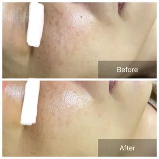 バフトアップ/ハーブ Nornのエステ・リラクイメージ