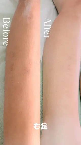 Hit. シュガーリング豊橋のエステ・リラクイメージ