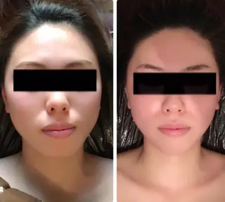 小顔•美肌•まつ毛 サロン Mimiの眉毛・アイブロウイメージ