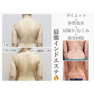 mooi【モーイ】所属・【北堀江】 痩身/小顔　mooiのエステ・リラクイメージ