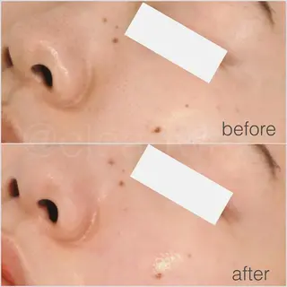 CLEAD赤坂見附店 坂田のエステ・リラクイメージ