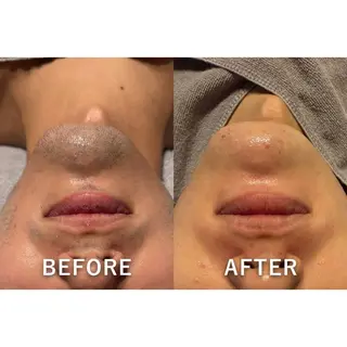 メンズ Aurora所属・目元美×脱毛 Clé-yunaのエステ・リラクイメージ