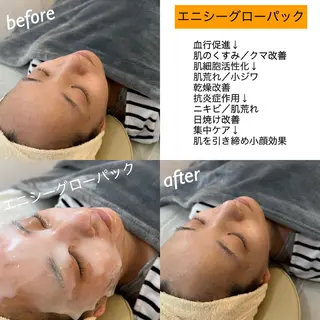 うなじ脱毛/美肌脱毛 LABELのエステ・リラクイメージ