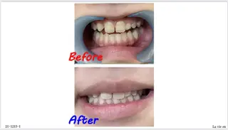 セルフホワイトニングサロン　ラヴィアン所属・ホワイトニングサロン La vie enのその他イメージ