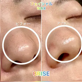 BRISE ブライズのエステ・リラクイメージ