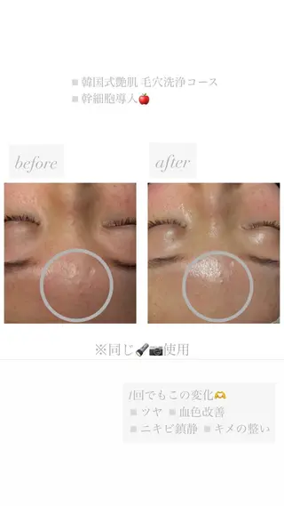 chouchou【シュシュ】所属・トータルボディケア chouchouのエステ・リラクイメージ