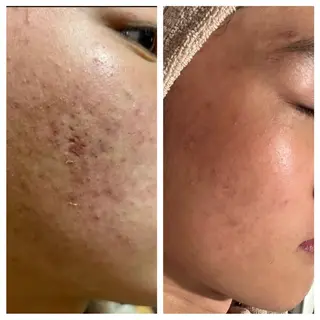 ANERA Second所属・尾上 沙織のエステ・リラクイメージ