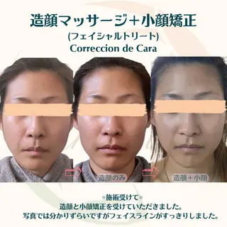 小顔矯正☀︎バスト ☀︎ハルのエステ・リラクイメージ