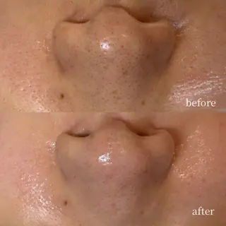 韓国肌管理・肌質改善 EARNEST心斎橋のエステ・リラクイメージ