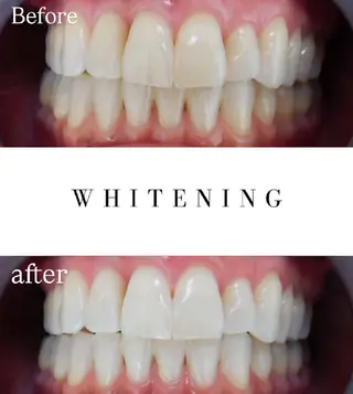 Luv the TERRACEの眉毛・アイブロウイメージ