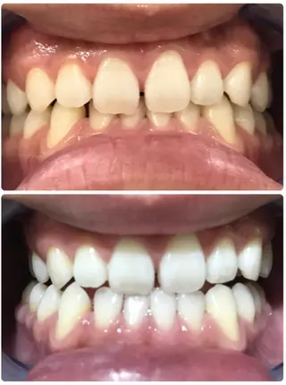 Beautyサロン noel de miのエステ・リラクイメージ